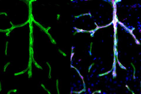 The brains plumbing: how brain blood vessels contribute to brain health and dementia